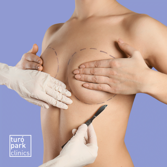 Breast Lift in Barcelona - Turo Park Aesthetic Clinic