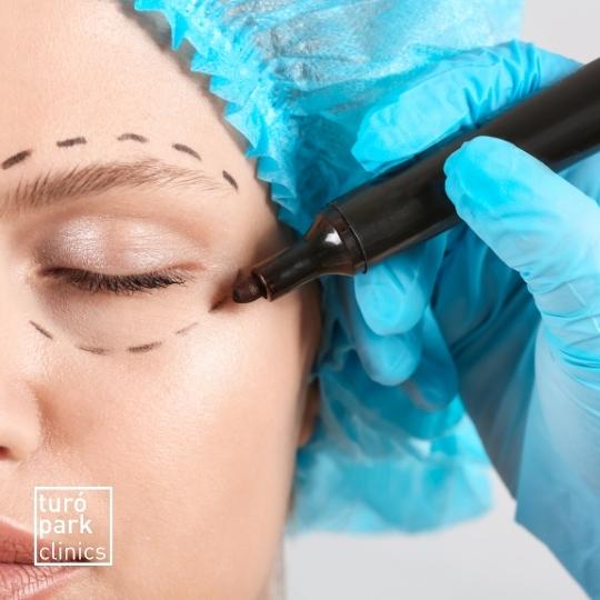 Blepharoplasty treatment