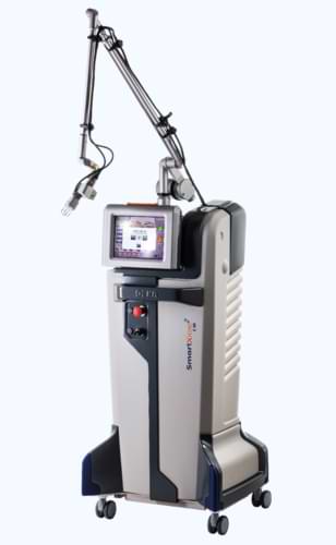 smartxide2 laser