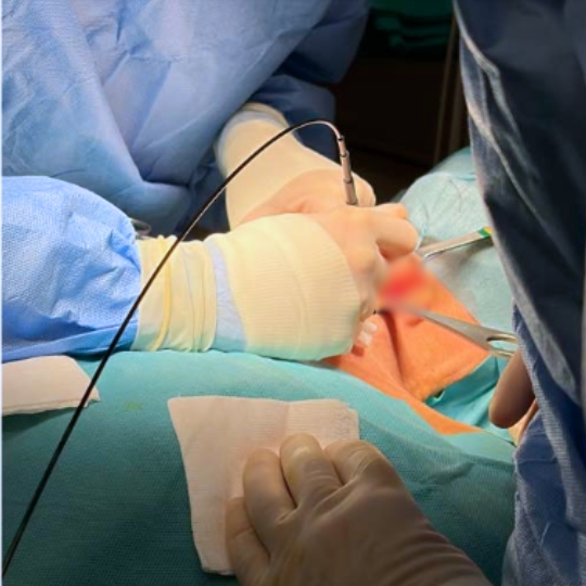 Cirugia paratiroides