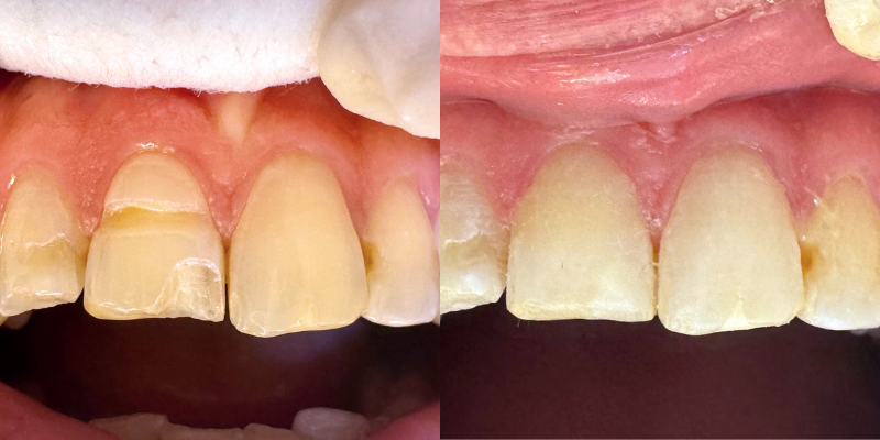 Reconstrucción Estética